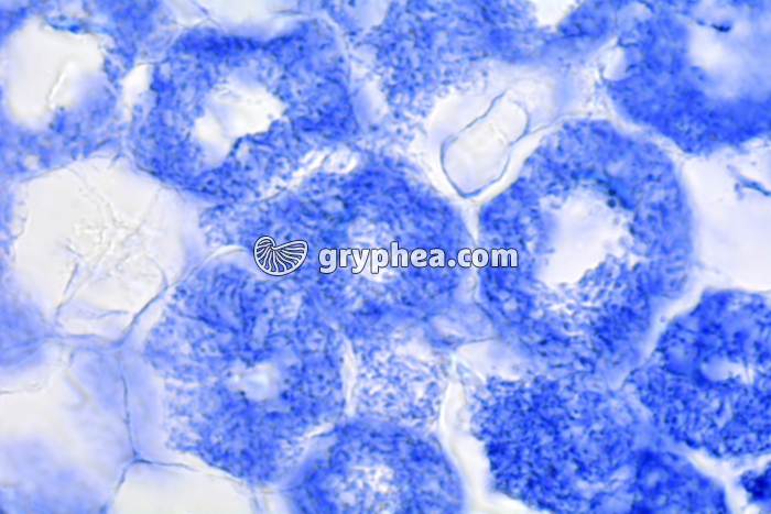 Racine de Trèfle montrant les cellules d'une nodosité '(association symbiotique avec des bactéries) - Bactéries dans les cellules racinaires x400 - gryphea.com